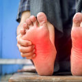 Expert Tips for Managing Diabetic Foot Problems